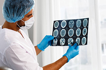 doctor examine stroke x-ray