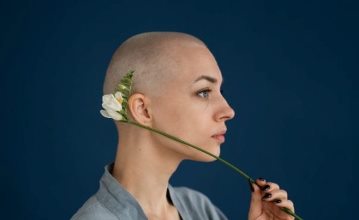 cancer-patient-with -hair-loss
